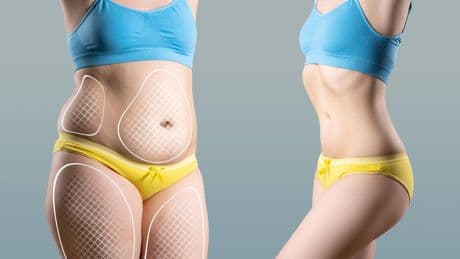 “La grasa abdominal es un precursor de la grasa visceral, la más peligrosa”: las últimas técnicas y tratamientos para conseguir un vientre plano