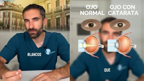 Alfonso Casado, oftalmólogo: “Si los colores te parecen más apagados y te deslumbra el coche de frente, podrían ser cataratas”