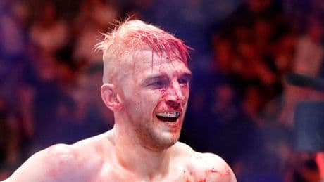 Dan Hooker claims ‘UFC doesn’t respect me’ after ticket controversy