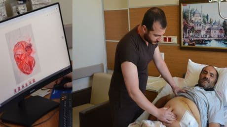 Karın şişliği için hastaneye gitti, böbreğinden 23 santimetrelik kist çıkarıldı