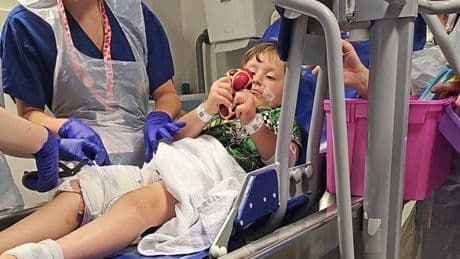 Mum's horror as boy, 4, 'scarred for life' after being savaged by neighbour's dogs