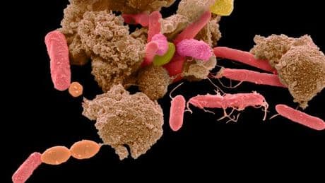 Les tests de microbiote intestinal sont peu fiables, selon une étude