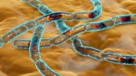 Anthrax warning as one dead and more hospitalised following outbreak
