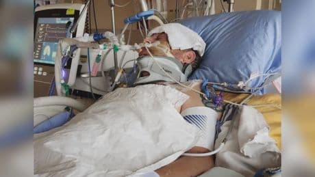 Kelowna beach attack victim left with brain injury, semi-paralyzed