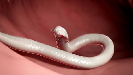 Das ist eklig! Diese Parasiten lauern auf Ihrem Teller – und so schützen Sie sich