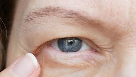 ¿Cómo poner solución a la mirada cansada?