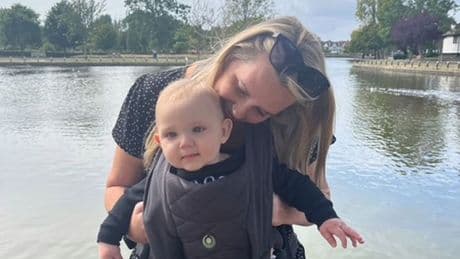 My baby’s head-to-toe rash bleeds and looks like chemical burns – cruel strangers are vile and kids won’t play with him