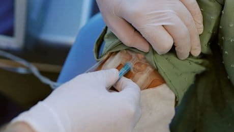 Otolog kök hücre nakli MS’te umut veriyor