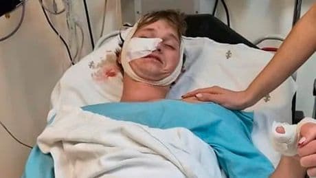 Mitten im Schlaf - Hyänen fallen in seinem Zelt über Nicolas (27) her