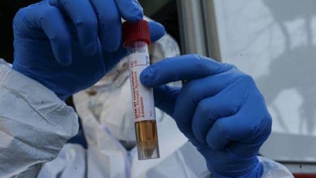 Gwada, la donna col sangue unico al mondo, “compatibile” solo con se stessa