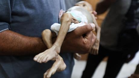 La desnutrición mata a cinco personas, incluido un bebé, en las últimas 24 horas en Gaza