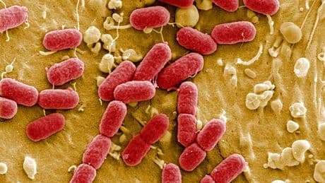 Intoxications par la bactérie E. coli dans l'Aisne: deux nouveaux cas enregistrés chez des enfants