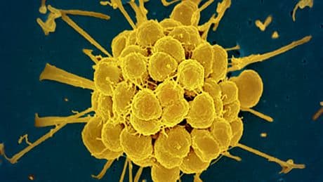 El primer antibiótico descubierto en 30 años llega justo a tiempo de evitar que la supergonorrea sea imposible de tratar