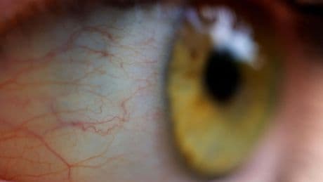 Nationwide eye care product recall as experts warn to stop using this product immediately