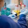 Coronavirus: WHO-Rat: China mauert - Ursprung des Coronavirus unklar