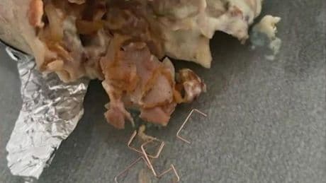 Ingresada una menor tras comer un kebab con grapas en su interior