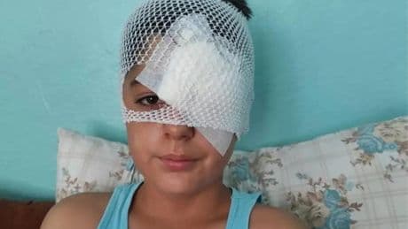 Şanlıurfa'da köpek saldırısından kaçarken otomobilin çarptığı çocuk hastaneye kaldırıldı