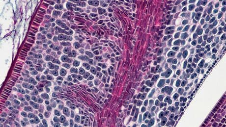 Des scientifiques ont trouvé un puissant moyen de prévenir l'apparition du cancer