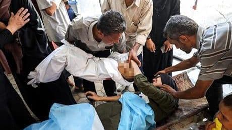 The Guardian yazdı: Gazze'deki saldırılarda ölen her altı kişiden beşi sivil