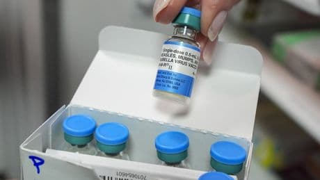 New Brunswick reports case of measles in south central region, says more are likely