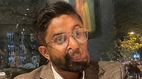 Man claims staff at a London cafe refused to serve him because of his face tumours