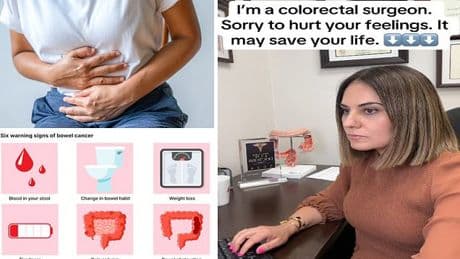 I'm a colon cancer doctor - and these are six hard truths everyone under 50 needs to know: 'They might save your life'