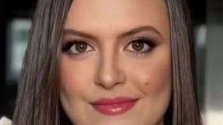 Woman, 22, dies after suffering severe allergic reaction following CT scan