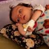 Artsen zonder Grenzen kent in Gaza tientallen gevallen van bijzondere ziekte: ‘Zeldzaam syndroom’