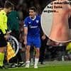 Athletic Bilbao star shows off gruesome injury after Victor Lindelof's horror tackle went unpunished in Man United clash