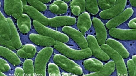 Alerta roja por la bacteria 'come carne': aumentan a ocho las muertes en EEUU y ya preocupa en Europa