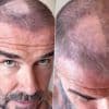 Doe het zelf-kapsel van David Beckham loopt vreselijk mis: “Zeg eerlijk, hoe erg is het?”