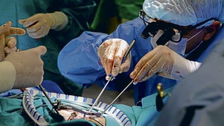 Herzgesundheit | Prävention weiter unterbelichtet