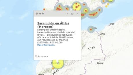 Los casos de sarampión se disparan hasta los 229 y el 78% viene de Marruecos