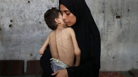 With EVERY photo of a ‘starving’ Gazan proving fake, how can you believe the famine claims?