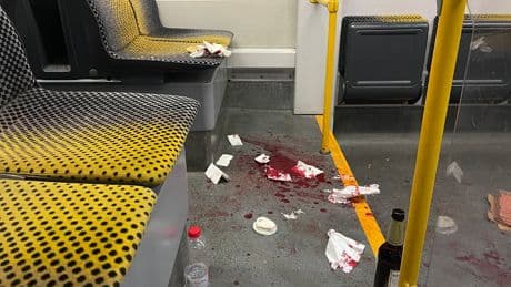 Messer-Opfer aus Straßenbahn spricht - „Er wollte mich töten“