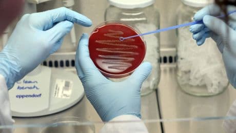 AI ontwerpt revolutionaire medicijnen tegen resistente bacteriën: ’Tweede gouden eeuw voor antibiotica’