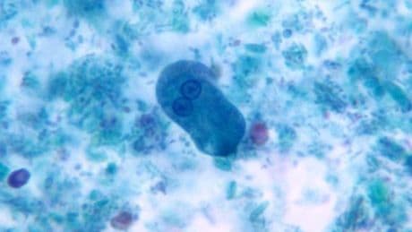 Ce parasite se déguise en cellule humaine pour échapper à notre système immunitaire