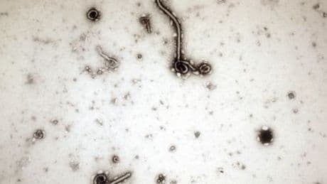 Ebola-Verdachtsfall in Tschechien löst Großeinsatz aus