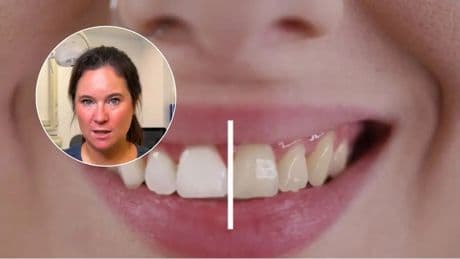 Almudena Herraiz, ortodoncista, sobre los dientes amarillos: "No solo son por falta de higiene"