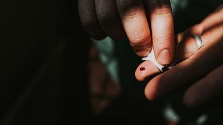 Pathologie: Tote Diabetiker verwesen schneller als Nichtdiabetiker. Stimmt's?