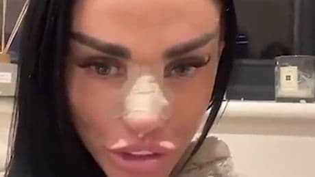 Katie Price reveals every facial surgery she's ever had - and one that left lifelong scars