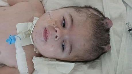 25 ayda 16 ameliyat geçirdi! Minik Ayaz yaşam mücadelesi veriyor