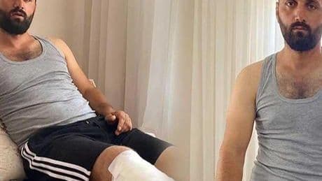 Tarlada dehşet dakikaları! ‘Ayı dişlerini bacağıma geçirdi'