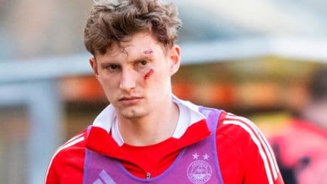 Man to appear in court after Aberdeen star hit by seat thrown from crowd