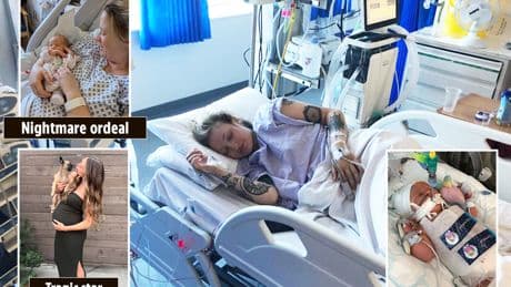My heart stopped & I lost all my blood as I gave birth after suffering deadly pregnancy condition that kills 4 in 5