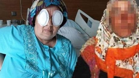 Babaannesini baltayla öldüren şizofreni hastası, 5 yıl sonra başka bir hastanın daha gözlerini oydu
