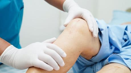 The secret to faster hip and knee surgeries? Fixing referrals, study says