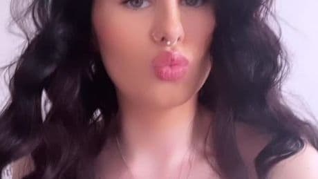 Mum shares horrifying photos after baby bottle ‘explosion peeled half her nipple off’ and left her fearing she’d die