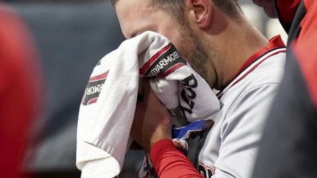 Nats' Paul DeJong relieved his vision wasn't affected by pitch to face that broke multiple bones