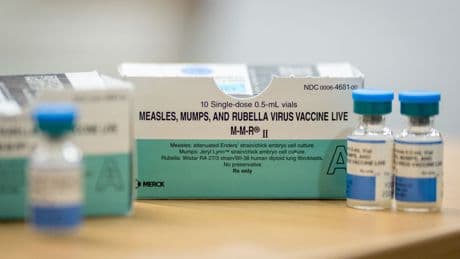 Measles Cases Are at a 33-Year High. Experts Warn Other Diseases Could Follow